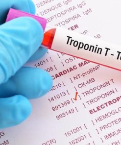 Xét nghiệm định lượng Troponin T/I