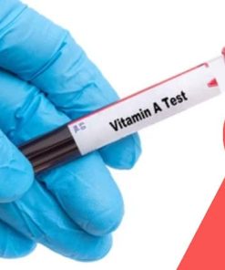 Xét nghiệm định lượng vitamin A