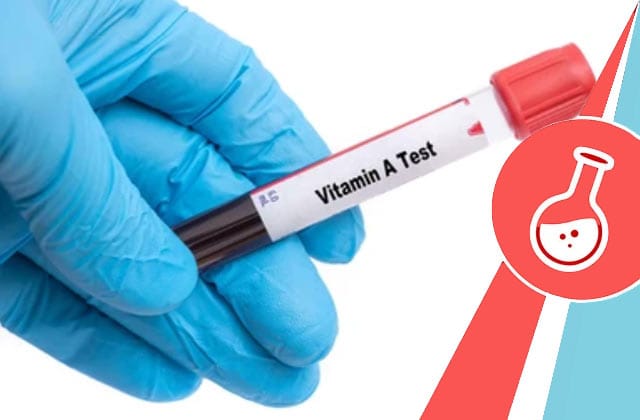 Xét nghiệm định lượng vitamin A