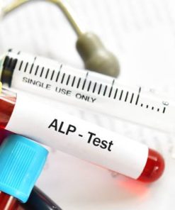 Xét nghiệm đo hoạt độ ALP