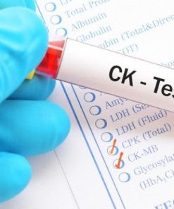 Xét nghiệm đo hoạt độ CK (Creatinin kinase)