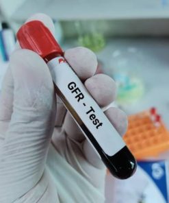 Xét nghiệm egfr đánh giá chức năng thận