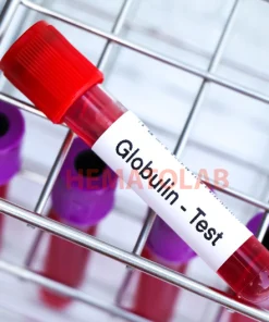Xét nghiệm định lượng Globulin máu