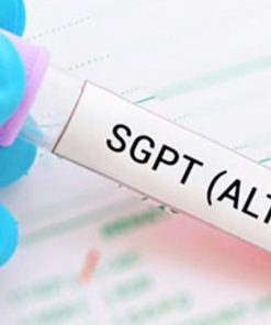 Xét nghiệm đo hoạt độ ALT (GPT)