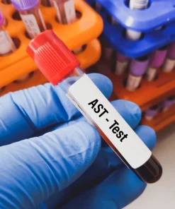 Xét nghiệm đo hoạt độ AST (GOT)