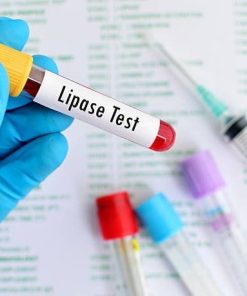 Xét nghiệm Lipase máu
