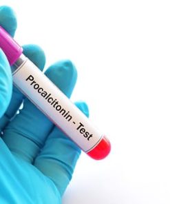 Xét nghiệm Procalcitonin (PCT) máu
