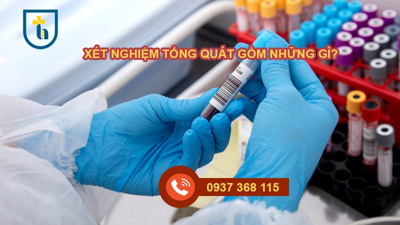 Xét nghiệm tổng quát tại nhà