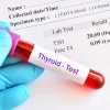 Xét nghiệm định lượng T3 Triiodothyronine