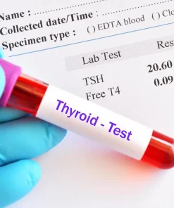Xét nghiệm định lượng T3 Triiodothyronine