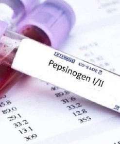 Xét nghiệm viêm dạ dày và ung thư dạ dày Pepsinogen
