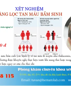 Xét nghiệm sàng lọc tan máu bẩm sinh ở trẻ em
